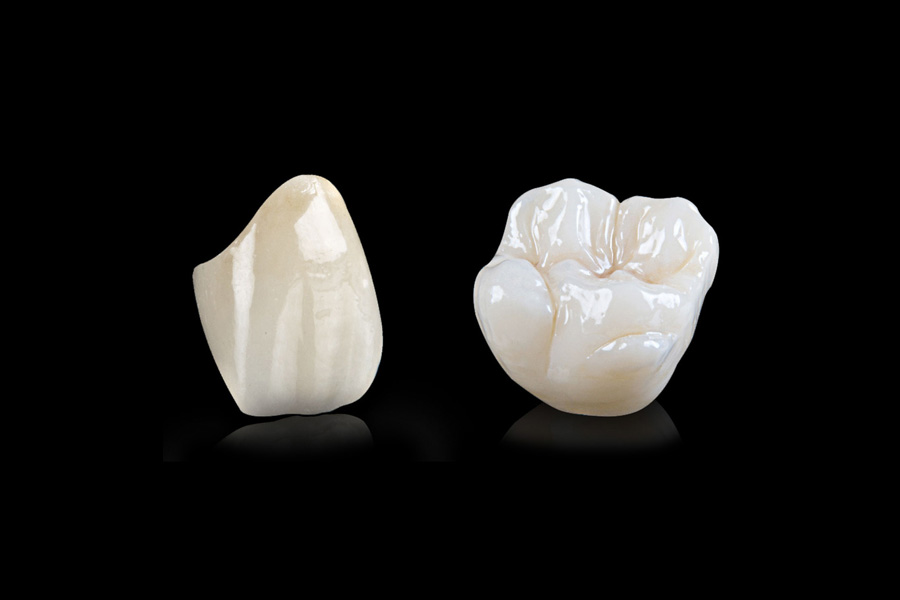 Ljuskice za zube i keramičke dentalne krunice, Zagreb Ljuskica za zube i keramička dentlana krunica na crnoj pozadini