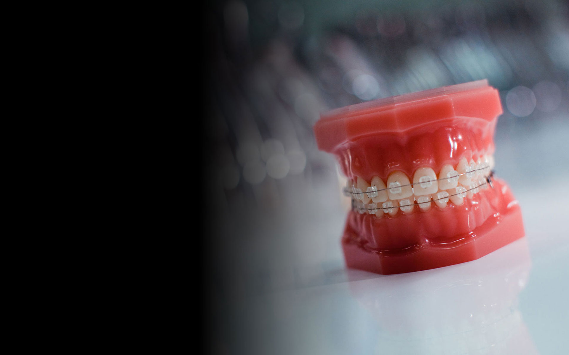 Ortodontski model obje čeljusti s postavljenim estetskim apratićima za zube