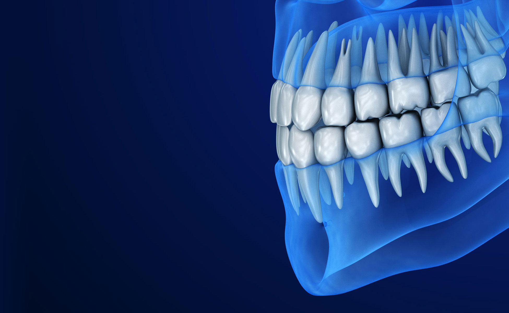 Plava pozadina 3D shematski prikaz zuba gornje i donje vilice