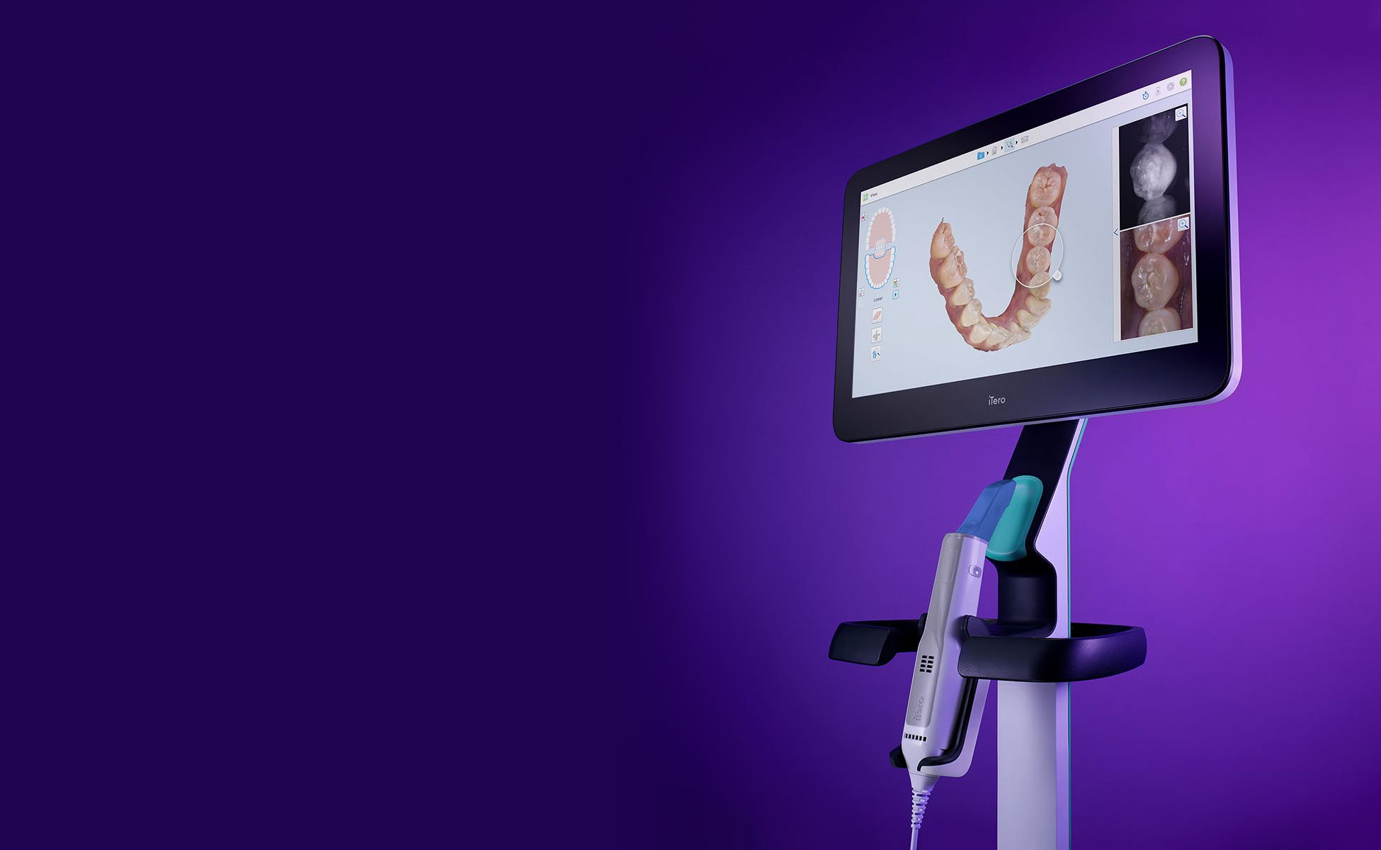 Ljubičasta pozadina, iTero intraoralni skener kolica na desnoj strani